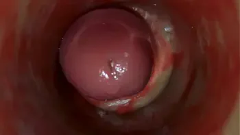 Camera Inside Deep Pussy Captures Huge Ejaculation of Sperm ASMR