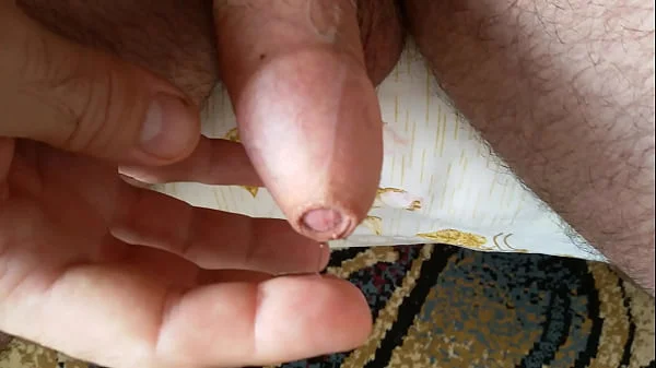 Penis Inspection