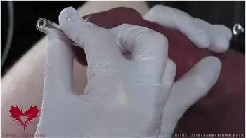Perfect Extraction Of Sperm Directly From The Urethra. Close-up Of The Glass Straw Sounding