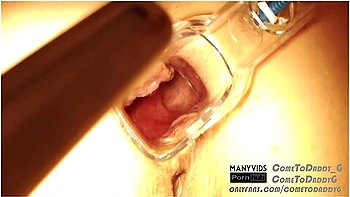 Anal Madness With Milf (free Full Video 4k)