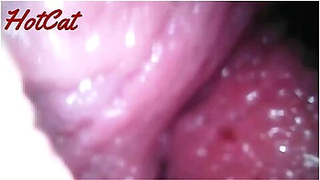 Endoscopic Vaginal Observation