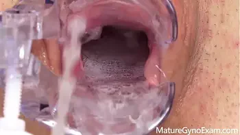 Mature gyno exam - Lucy